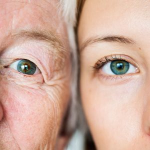 Can-Glaucoma-be-genetic