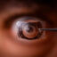 glaucoma surgery cost in US