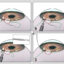 Canaloplasty Surgery