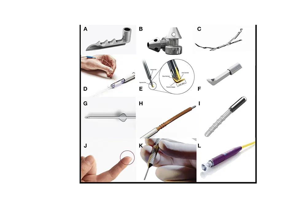 MIGS Surgery UK