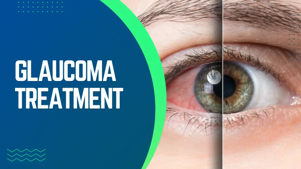 Does Insurance Cover Glaucoma Surgery in Germany