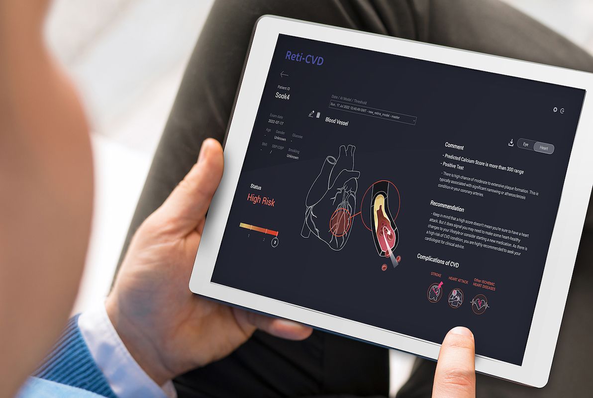 AI Eye Exams Detect Heart Disease Risk Early