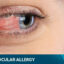 Dry-Eye-Disease-Common-Among-Eye-Care-Professionals