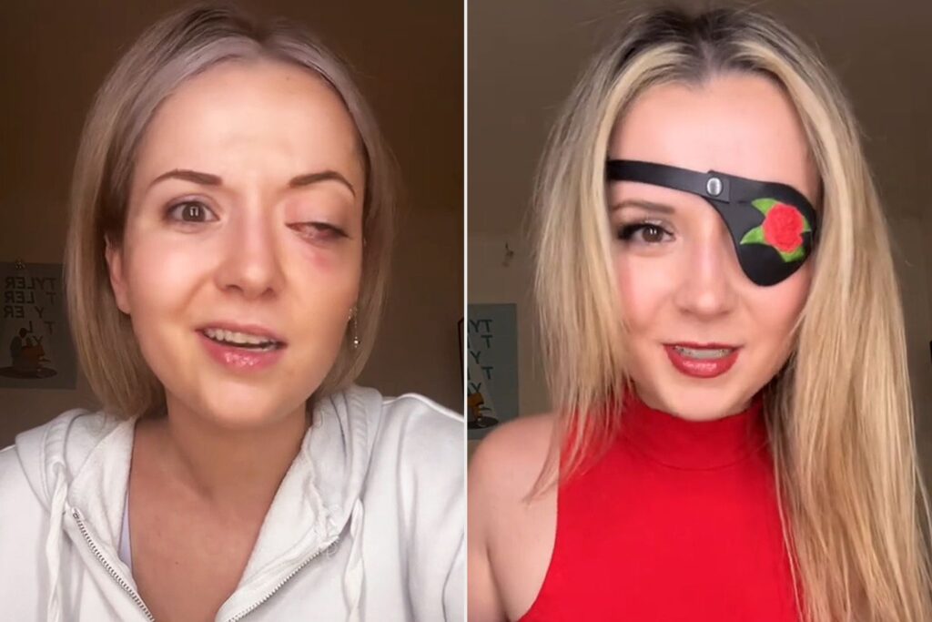 Eye Issue Misdiagnosed Woman Losing Sight at 37
