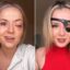 Eye Issue Misdiagnosed Woman Losing Sight at 37