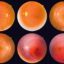 Eye Photos May Detect Chronic Health Problems Early