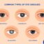 Hub-shares-new-insights-on-eye-disease-awareness