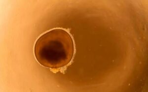 Lab-Grown Retina Study Reveals Gene Clue in Eye Disease