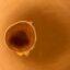 Lab-Grown Retina Study Reveals Gene Clue in Eye Disease