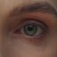 Midlife Eye Problems in Women Are More Treatable Than Ever
