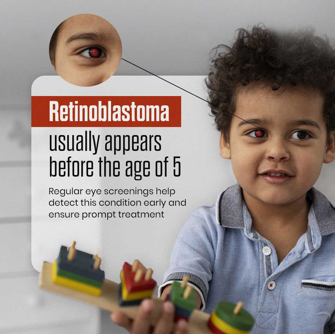 ASG Eye Hospital Drives Retinoblastoma Awareness Campaign