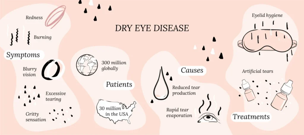 Dry Eye Disease Diagnosis Key Clinical Approaches