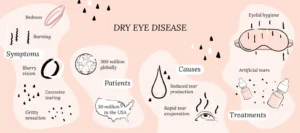 Dry Eye Disease Diagnosis: Key Clinical Approaches