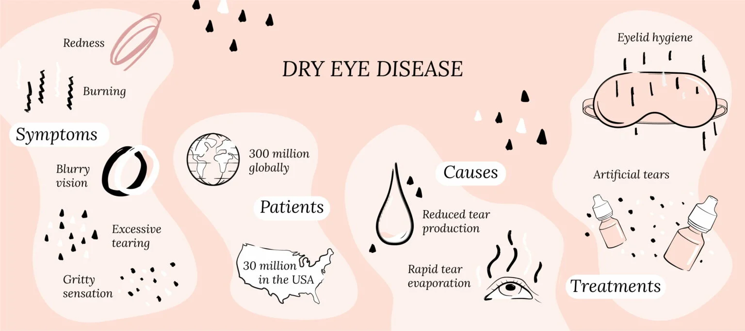 Dry Eye Disease Diagnosis: Key Clinical Approaches