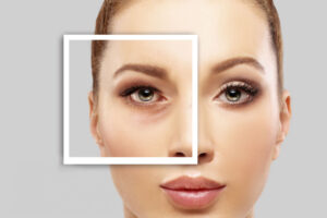 Summer Eye Problems: Why Heat Strains Your Vision Care