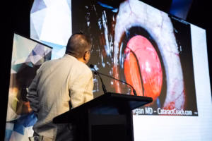 Glaucoma Eye Problem