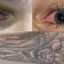 W5 Investigates They got tattoos when they were young, then the vision problems started