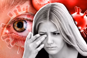 COVID lasting eye problems