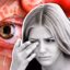 eye problem in covid