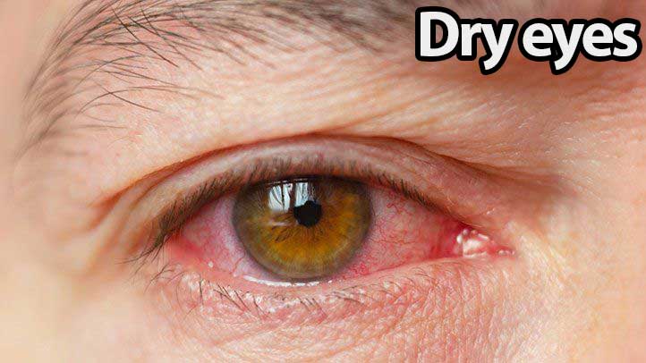 Oral Contraceptives and Dry Eye Disease: Risks and Care