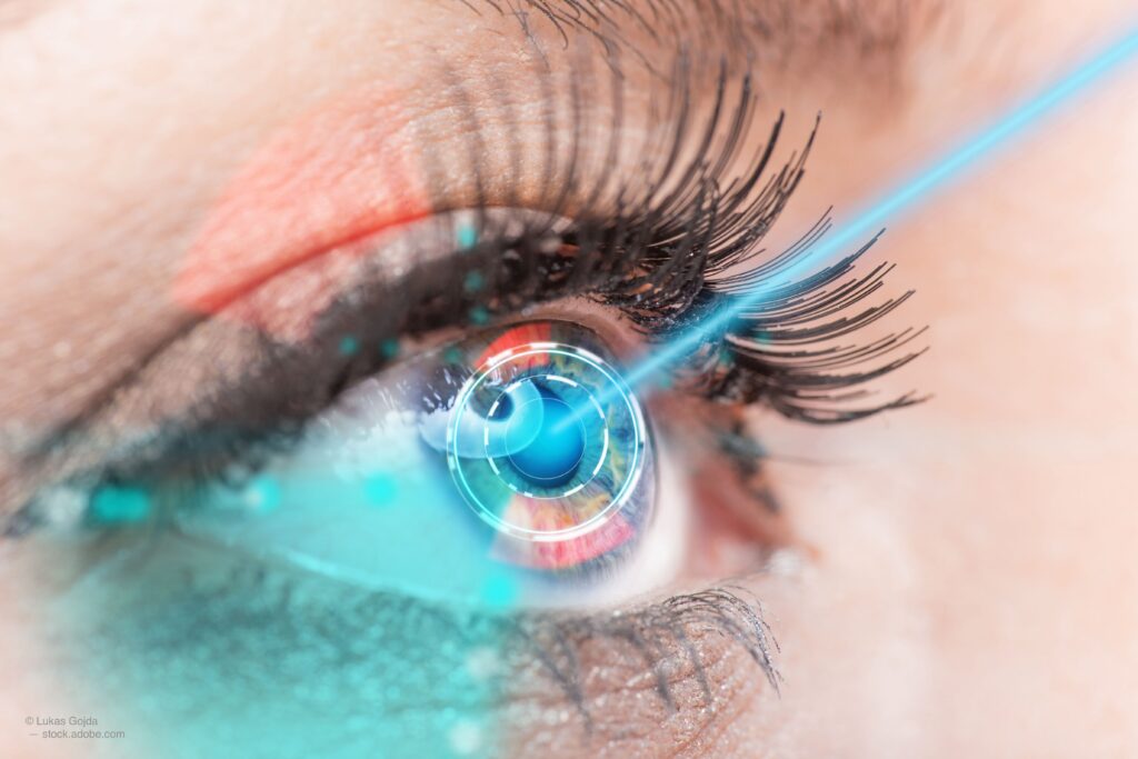 Glaucoma treatment rates New Zealand