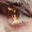 Air Pollution Linked to Eye Disease Risk