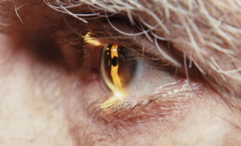 Air Pollution Linked to Eye Disease Risk