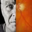 New Zealand glaucoma care shows progress, yet gaps in treatment remain