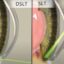 SLT-vs-DSLT-Comparing-Laser-Glaucoma-Treatment-Outcomes