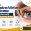 Understanding-Pseudoexfoliation-Syndrome