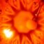 Glaucoma Research Uncovers Clues to Optic Nerve Damage